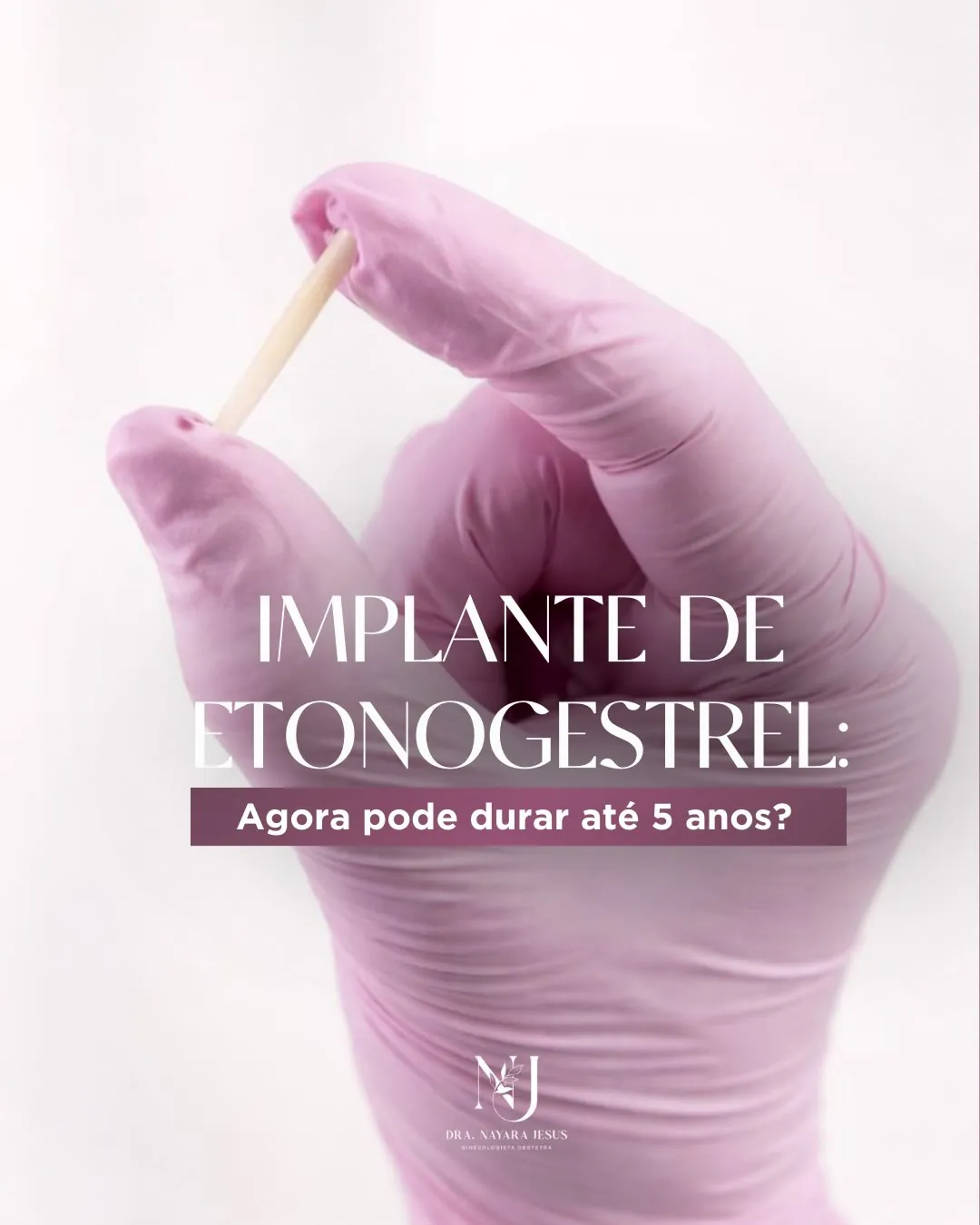 Implante de etonogestrel